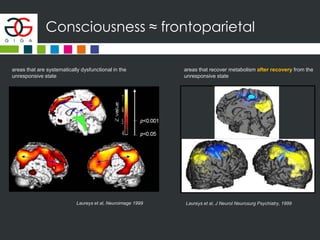 Consciousness ≈ frontoparietal
Laureys et al, Neuroimage 1999
areas that are systematically dysfunctional in the
unresponsive state
areas that recover metabolism after recovery from the
unresponsive state
Laureys et al, J Neurol Neurosurg Psychiatry, 1999
 