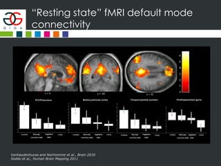 “Resting state” fMRI default mode
connectivity
Vanhaudenhuyse and Noirhomme et al., Brain 2010
Soddu et al., Human Brain Mapping 2011
 