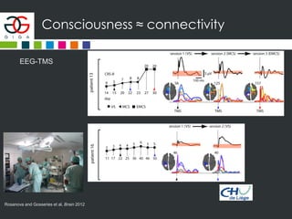 Consciousness ≈ connectivity
EEG-TMS
Rosanova and Gosseries et al, Brain 2012
 