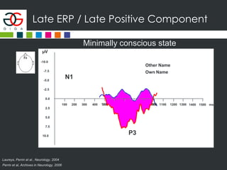Late ERP / Late Positive Component
Minimally conscious state
µV
0.0
-2.5
-5.0
-7.5
-10.0
2.5
5.0
7.5
10.0
Other Name
N1
ms100 300 500 800 1000 1300200 400 600 700 900 1100 1200 15001400
P3
Own Name
Laureys, Perrin et al., Neurology, 2004
Perrin et al, Archives in Neurology, 2006
 