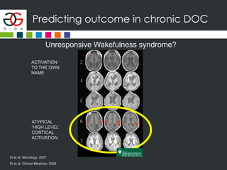 Predicting outcome in chronic DOC
Unresponsive Wakefulness syndrome?
ATYPICAL
‘HIGH LEVEL’
CORTICAL
ACTIVATION
Di et al, Neurology, 2007
ACTIVATION
TO THE OWN
NAME
Di et al, Clinical Medicine, 2008
 