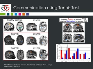 Communication using Tennis Test
Monti & Vanhaudenhuyse, Coleman, Boly, Pickard, Tshibanda, Owen, Laureys
New England J Med 2010
 