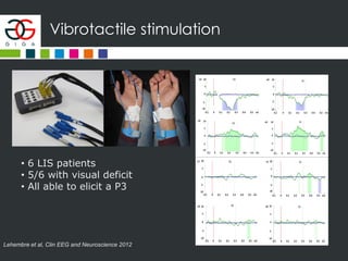 Vibrotactile stimulation
Lehembre et al, Clin EEG and Neuroscience 2012
• 6 LIS patients
• 5/6 with visual deficit
• All able to elicit a P3
 