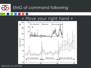 EMG of command following
« Move your right hand »
Bekinschtein et al, JNNP 2008
 