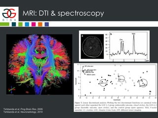 MRI: DTI & spectroscopy
Tshibanda et al, Prog Brain Res, 2009
Tshibanda et al, Neuroradiology, 2010
 