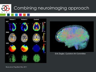 Combining neuroimaging approach
Bruno et al, Prog Brain Res, 2011
Erik Ziegler, Cyclotron Art Committee
 