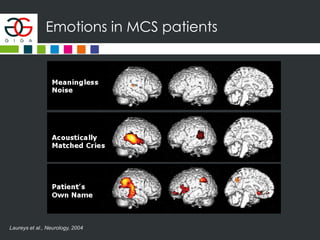 Emotions in MCS patients
Laureys et al., Neurology, 2004
 