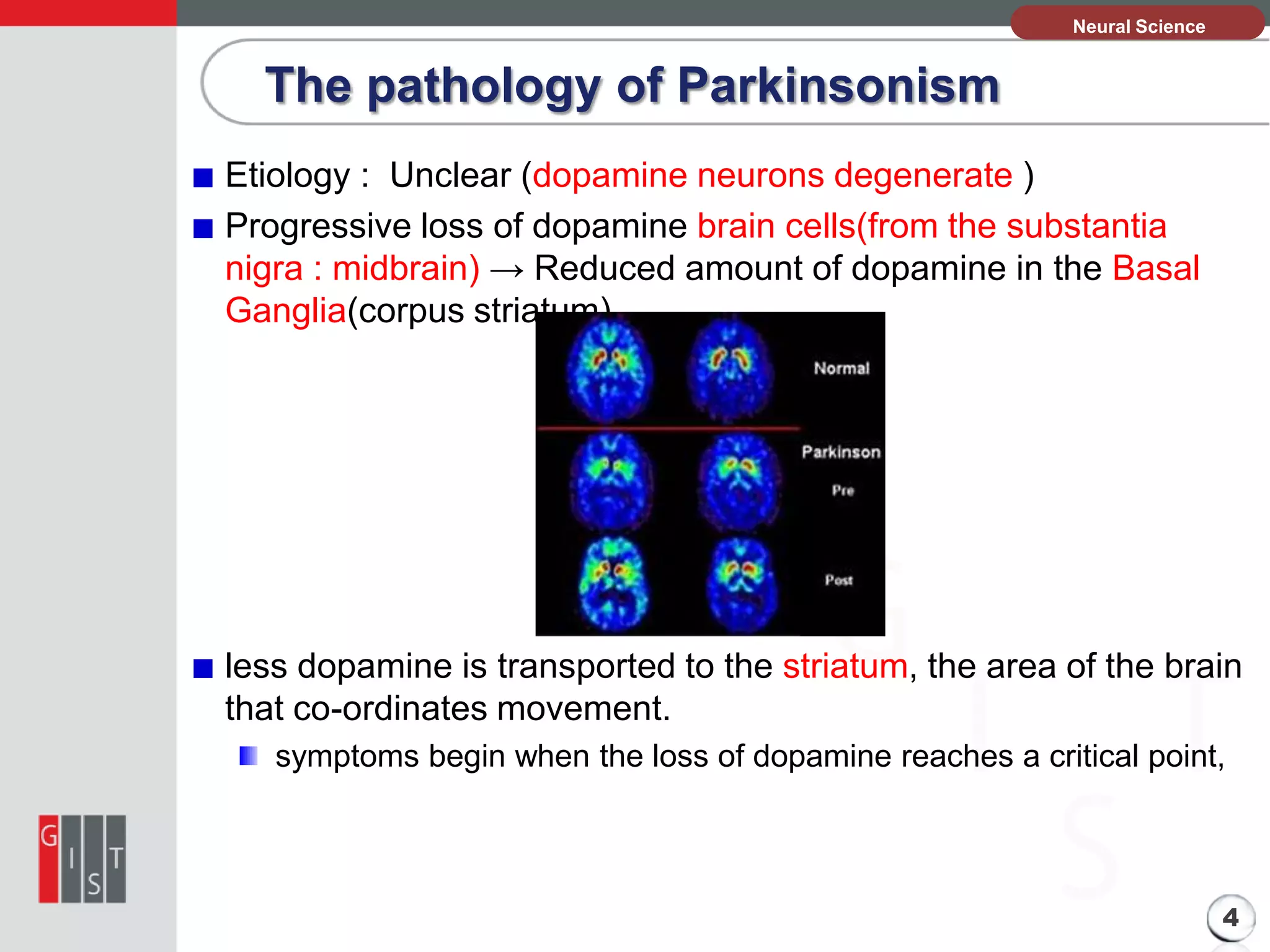 본Neural Science
과제의 기본 정보

The pathology of Parkinsonism
Etiology : Unclear (dopamine neurons degenerate )
Progressive loss of dopamine brain cells(from the substantia
nigra : midbrain) → Reduced amount of dopamine in the Basal
Ganglia(corpus striatum)

less dopamine is transported to the striatum, the area of the brain
that co-ordinates movement.
symptoms begin when the loss of dopamine reaches a critical point,

4

 