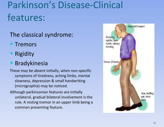 Parkinson’s Disease- Clinical features:  The classical syndrome:  Tremors Rigidity Bradykinesia These may be absent initially, when non-specific symptoms of tiredness, aching limbs, mental slowness, depression & small handwriting (micrographia) may be noticed.  Although parkinsonian features are initially unilateral, gradual bilateral involvement is the rule. A resting tremor in an upper limb being a common presenting feature.  