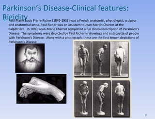 Paul Marie Louis Pierre Richer (1849-1933) was a French anatomist, physiologist, sculptor and anatomical artist. Paul Richer was an assistant to Jean-Martin Charcot at the Salpêtrière.  In 1880, Jean-Marie Charcot completed a full clinical description of Parkinson's Disease. The symptoms were depicted by Paul Richer in drawings and a statuette of people with Parkinson's Disease.  Along with a photograph, these are the first known depictions of Parkinson's Disease Parkinson’s Disease- Clinical features:  Rigidity  