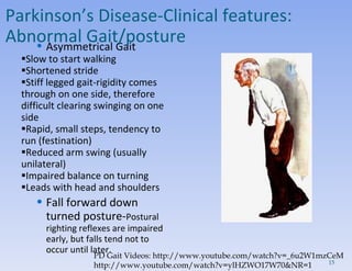Asymmetrical Gait Slow to start walking  Shortened stride Stiff legged gait-rigidity comes through on one side, therefore difficult clearing swinging on one side  Rapid, small steps, tendency to run (festination)  Reduced arm swing (usually unilateral)  Impaired balance on turning  Leads with head and shoulders Fall forward down turned posture- Postural righting reflexes are impaired early, but falls tend not to occur until later.  Parkinson’s Disease- Clinical features:  Abnormal Gait/posture PD Gait Videos: http://www.youtube.com/watch?v=_6u2W1mzCeM http://www.youtube.com/watch?v=ylHZWO17W70&NR=1 