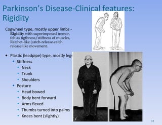 Parkinsons Disease Slide 12