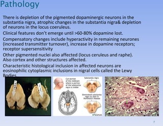 Parkinsons Disease Slide 7