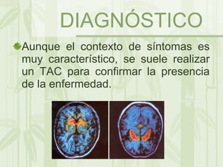 DIAGNÓSTICO Aunque el contexto de síntomas es muy característico, se suele realizar un TAC para confirmar la presencia de la enfermedad. 
