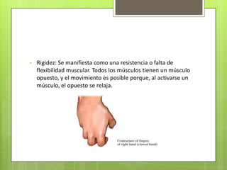 •   Rigidez: Se manifiesta como una resistencia o falta de
    flexibilidad muscular. Todos los músculos tienen un músculo
    opuesto, y el movimiento es posible porque, al activarse un
    músculo, el opuesto se relaja.
 