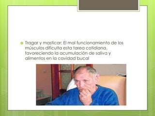   Tragar y masticar: El mal funcionamiento de los
    músculos dificulta esta tarea cotidiana,
    favoreciendo la acumulación de saliva y
    alimentos en la cavidad bucal
 