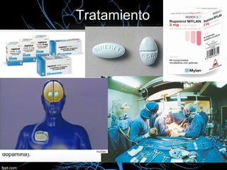 Tratamiento
• No se dispone de un tratamiento curativo.      Tratamiento quirúrgico:
• Tratamientos paliativos que alivian de            - Palidotomía( en desuso por la
forma mantenida los síntomas: fármacos y            Levodopa, demasiados riegos).
Cirugía.                                            - Transplantes(fase
 Fármacos:                                         experimental – tejido fetal,
- Levodopa(primera medida que se                    células animales capaces de
estableció contra la EP)                            producir dopamina).
- Levodopa/Cabidopa(combinación que                 - Estimulación cerebral
elimina los efectos secundarios del primero).       profunda.(mismo principio que
- Amantadina(favorece la producción y               los marcapasos cardíaco, se
retención de Dopamina).                             implantan en el hipotálamo y el
- Anticolinérgicos(control del temblor).            paciente puede controlarlo con
- Selegiline(retraso del comienzo con               un interruptor).  marcapasos
fármacos más agresivos - estadios iniciales).       cerebral.
- Agonistas dopaminérgicos(activan los
receptores dopaminérgicos).
- Inhibidores de la COMT(aumento niveles de
dopamina).
 