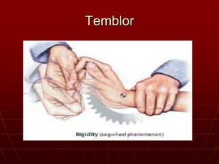 Temblor
 