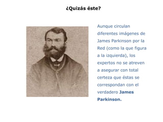 ¿Quizás éste?


           Aunque circulan
           diferentes imágenes de
           James Parkinson por la
           Red (como la que figura
           a la izquierda), los
           expertos no se atreven
           a asegurar con total
           certeza que éstas se
           correspondan con el
           verdadero James
           Parkinson.
 