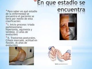 *
* Para saber en qué estadio
de la enfermedad se
encuentra el paciente se
lleva por medio de esta
clasificación:
* I. Inicio proceso: triada
parkinsoniana:
hipertonía, aquinesia y
temblor. (3 años de
evolución)
* II. Trastornos posturales.
Cifosis marcada, actitud en
flexión. (6 años de
evolución)
 