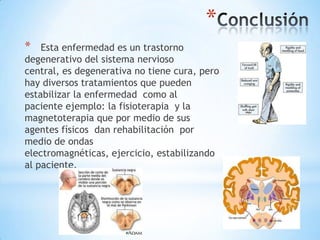 *
*   Esta enfermedad es un trastorno
degenerativo del sistema nervioso
central, es degenerativa no tiene cura, pero
hay diversos tratamientos que pueden
estabilizar la enfermedad como al
paciente ejemplo: la fisioterapia y la
magnetoterapia que por medio de sus
agentes físicos dan rehabilitación por
medio de ondas
electromagnéticas, ejercicio, estabilizando
al paciente.
 