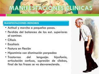 MANIFESTACIONES MENORES
• Actitud y marcha a pequeños pasos.
• Perdida del balanceo de las ext. superiores
al caminar.
• Cifosis
• Escoliosis
• Postura en flexión
• Hipomimia con disminución parpadeo
• Trastornos del lenguaje: hipofonía,
articulación confusa, supresión de sílabas,
final de las frases se va desvaneciendo.
 