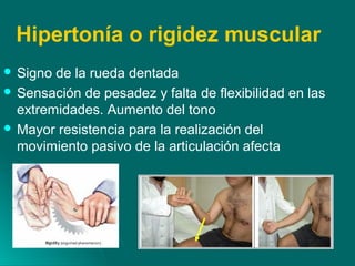 Hipertonía o rigidez muscular
 Signo de la rueda dentada
 Sensación de pesadez y falta de flexibilidad en las
extremidades. Aumento del tono
 Mayor resistencia para la realización del
movimiento pasivo de la articulación afecta
 