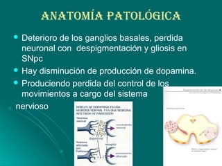 ANATOmÍA PATOLóGIcA
 Deterioro de los ganglios basales, perdida
neuronal con despigmentación y gliosis en
SNpc
 Hay disminución de producción de dopamina.
 Produciendo perdida del control de los
movimientos a cargo del sistema
nervioso
 