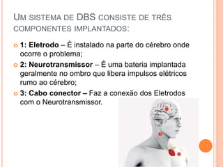 UM SISTEMA DE DBS CONSISTE DE TRÊS
COMPONENTES IMPLANTADOS:
 1: Eletrodo – É instalado na parte do cérebro onde
ocorre o problema;
 2: Neurotransmissor – É uma bateria implantada
geralmente no ombro que libera impulsos elétricos
rumo ao cérebro;
 3: Cabo conector – Faz a conexão dos Eletrodos
com o Neurotransmissor.
 
