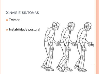 SINAIS E SINTOMAS
 Tremor;
 Instabilidade postural
 