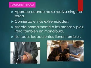  Aparece cuando no se realiza ninguna
tarea.
 Comienza en las extremidades.
 Afecta normalmente a las manos y pies.
Pero también en mandíbula.
 No todos los pacientes tienen temblor.
TEMBLOR EN REPOSO
 