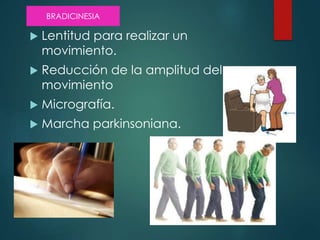  Lentitud para realizar un
movimiento.
 Reducción de la amplitud del
movimiento
 Micrografía.
 Marcha parkinsoniana.
BRADICINESIA
 