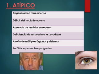 1. ATÍPICO
Degeneración más extensa
Déficit del habla temprana
Ausencia de temblor en reposo.
Deficiencia de respuesta a la Levodopa
Atrofia de múltiples órganos y sistemas
Parálisis supranuclear progresiva
 
