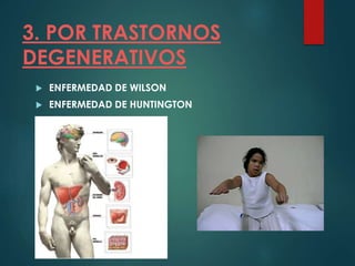 3. POR TRASTORNOS
DEGENERATIVOS
 ENFERMEDAD DE WILSON
 ENFERMEDAD DE HUNTINGTON
 