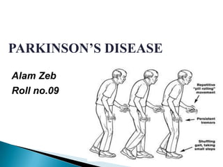 PARKINSON’S DISEASE
Alam Zeb
Roll no.09
 