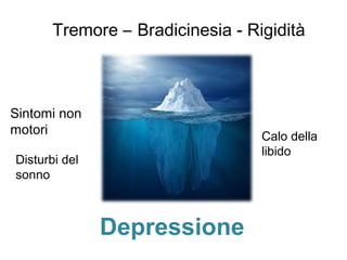 Tremore – Bradicinesia - Rigidità
Depressione
Sintomi non
motori
Disturbi del
sonno
Calo della
libido
 