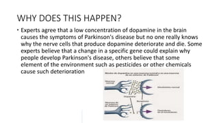 WHY DOES THIS HAPPEN?
 Experts agree that a low concentration of dopamine in the brain
causes the symptoms of Parkinson's disease but no one really knows
why the nerve cells that produce dopamine deteriorate and die. Some
experts believe that a change in a specific gene could explain why
people develop Parkinson's disease, others believe that some
element of the environment such as pesticides or other chemicals
cause such deterioration
 