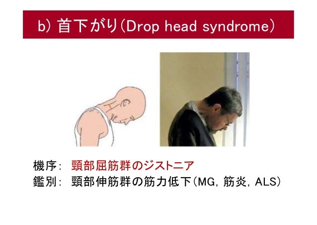 Parkinson disease pain and surgery