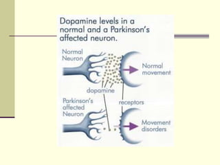 Parkinson disease pd