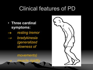 Clinical features of PD
• Three cardinal
symptoms:
 resting tremor
 bradykinesia
(generalized
slowness of
movements)
 muscle rigidity
 