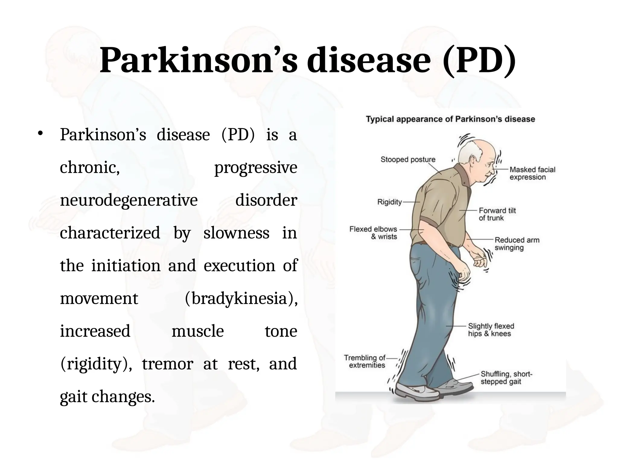 Parkinson disease Clinical Manifestations and Treatment | PPTX