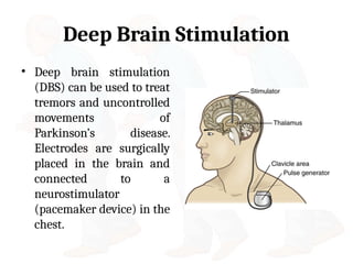 Parkinson disease Clinical Manifestations and Treatment | PPTX