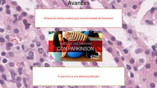 Avances
Terapia de células madre para la enfermedad de Parkinson
El ejercicio y una dieta equilibrada
 