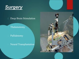 Surgery
Deep Brain Stimulation
Thalamotomy
Pallidotomy
Neural Transplantation
 