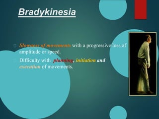 Bradykinesia
Slowness of movements with a progressive loss of
amplitude or speed.
Difficulty with planning, initiation and
execution of movements.
 