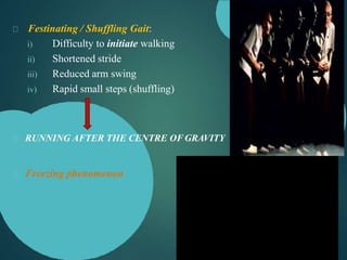 Festinating / Shuffling Gait:
i) Difficulty to initiate walking
ii) Shortened stride
iii) Reduced arm swing
iv) Rapid small steps (shuffling)
RUNNING AFTER THE CENTRE OF GRAVITY
Freezing phenomenon
 