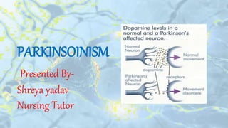 PARKINSOINISM
Presented By-
Shreya yadav
Nursing Tutor
 