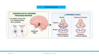 2
30/07/2026 TKCP WARANANAGAR
PATHOGENISIS
 