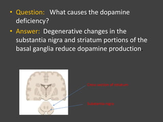 • Question: What causes the dopamine
deficiency?
• Answer: Degenerative changes in the
substantia nigra and striatum portions of the
basal ganglia reduce dopamine production.
Cross section of striatum
Substantia nigra
 