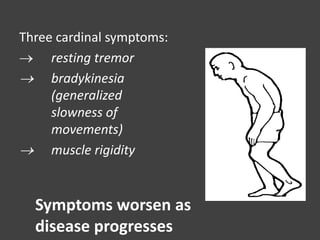 Three cardinal symptoms:
 resting tremor
 bradykinesia
(generalized
slowness of
movements)
 muscle rigidity
Symptoms worsen as
disease progresses
 
